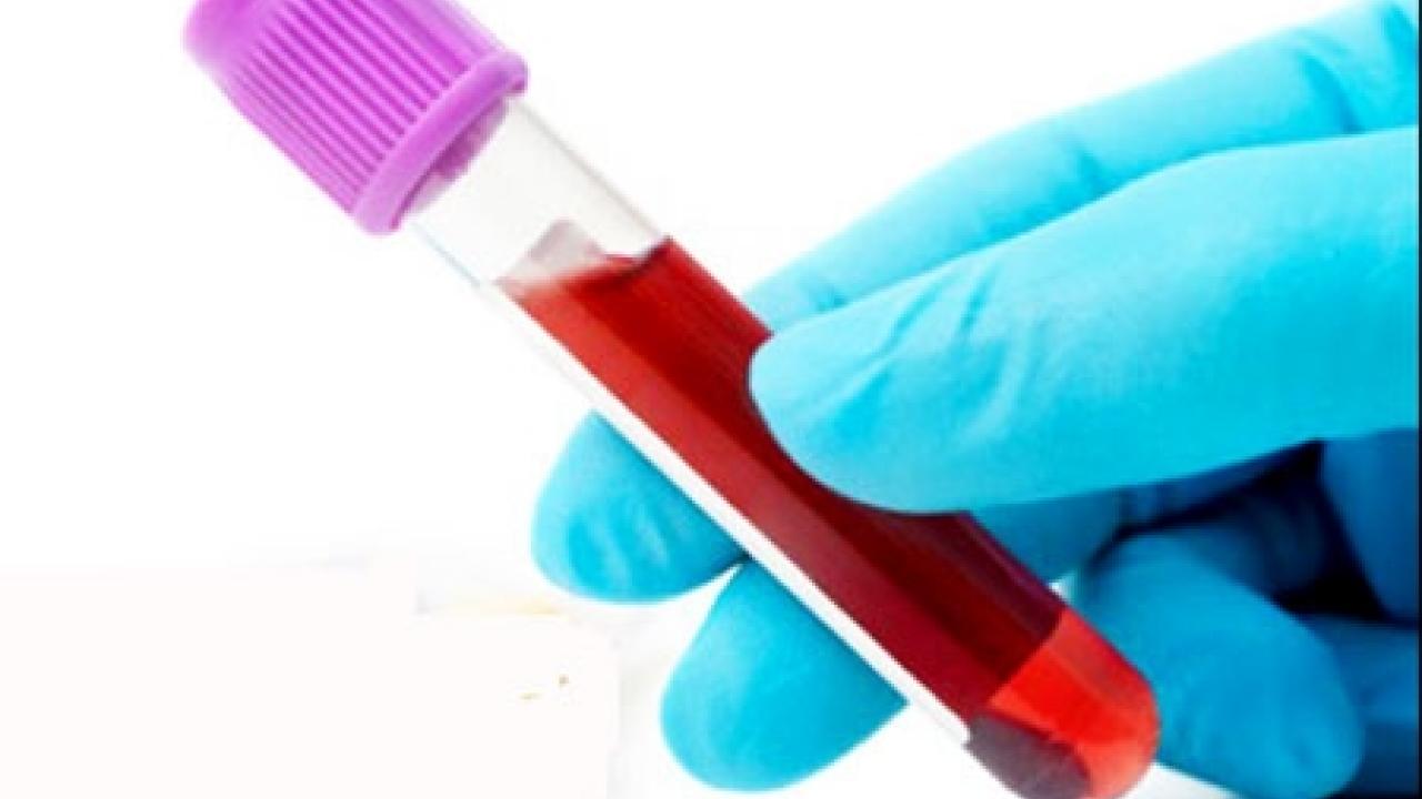 WalkIn Lyme Clinic Lyme Disease