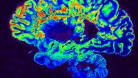 A heat map of a brain.